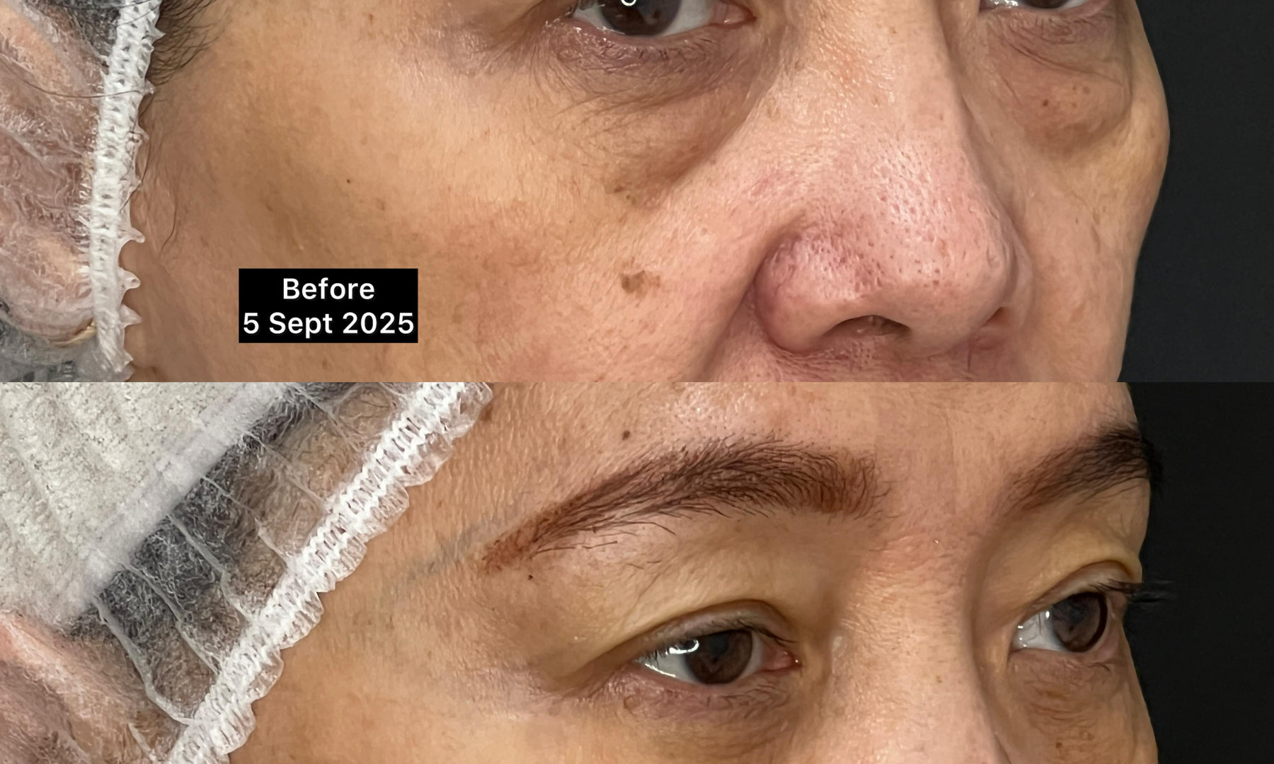 Perawatan kulit di ADC Aesthetic Derma Centre Bandung