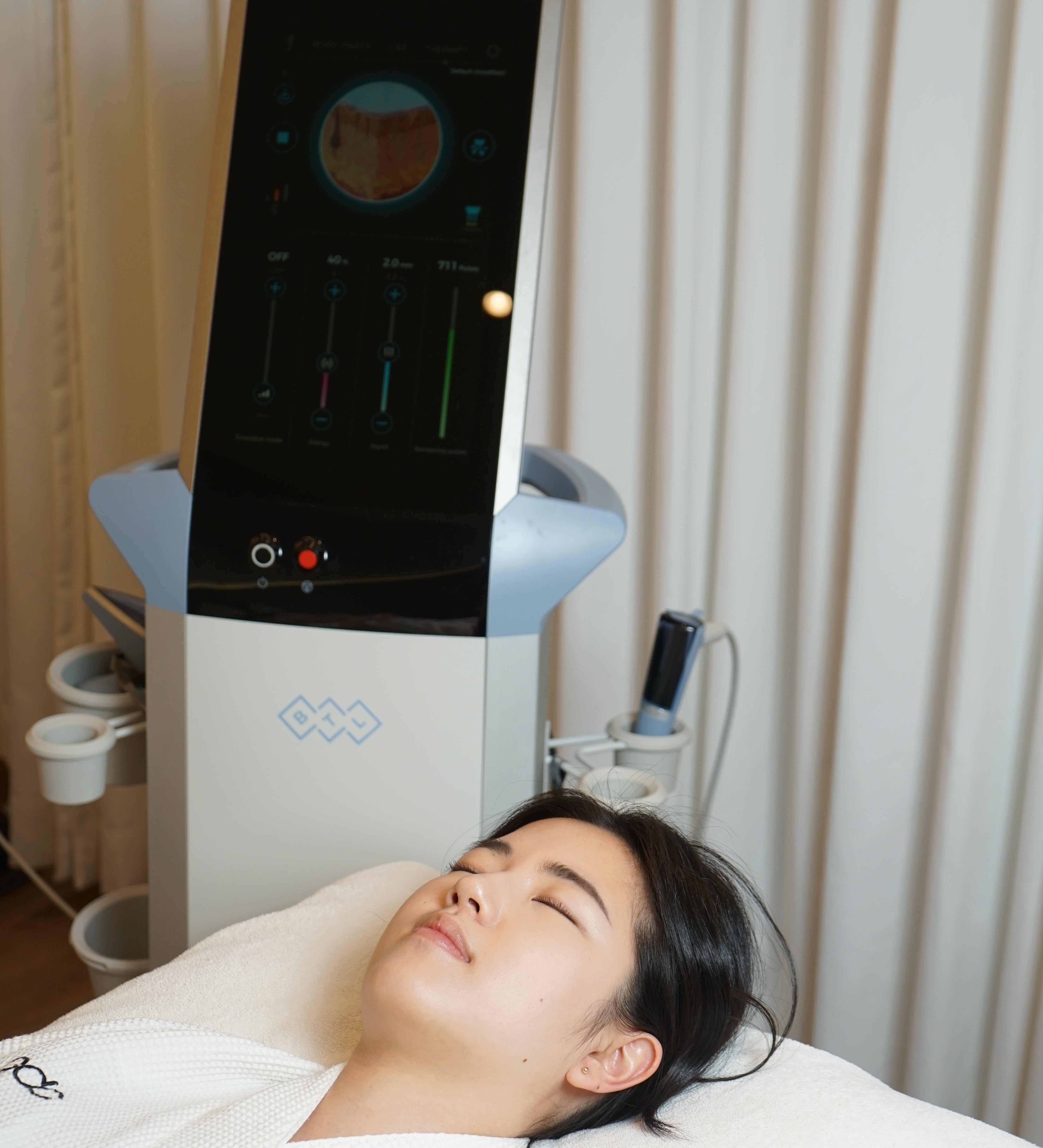 Person lying on a white mat with a Microneedling RF device displaying a graph.