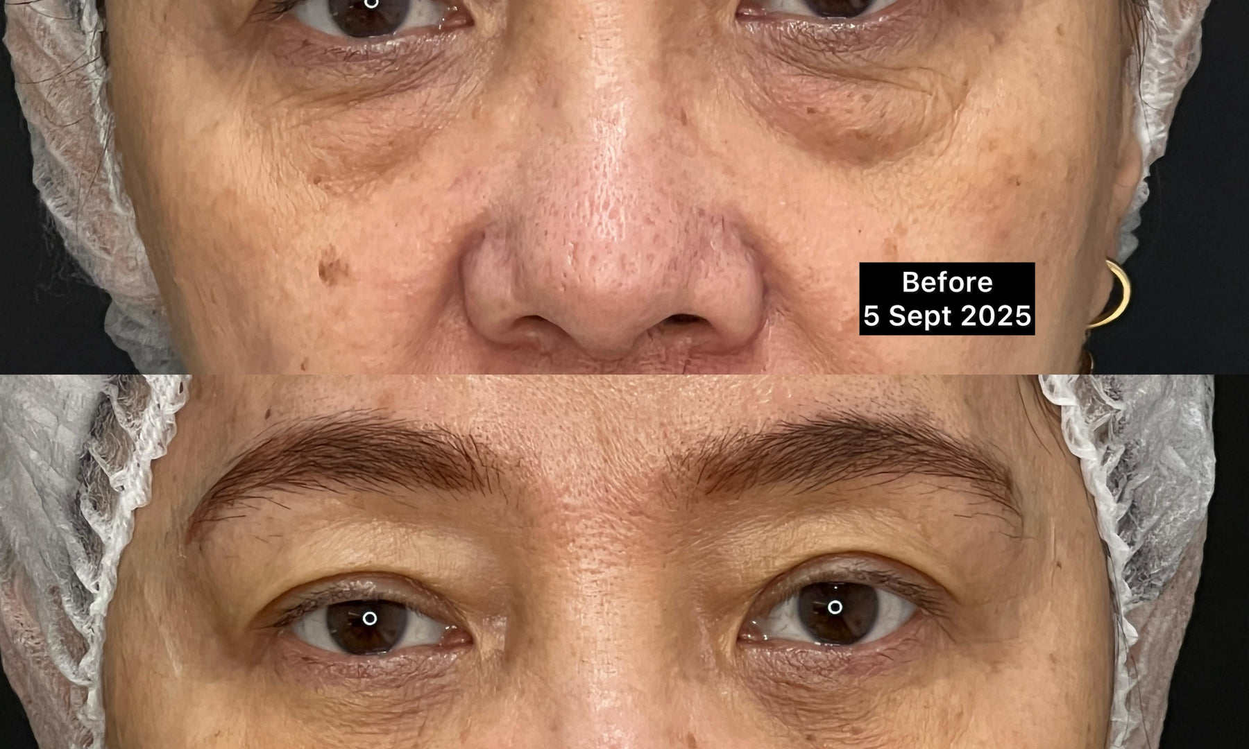 Perawatan kulit di ADC Aesthetic Derma Centre Bandung