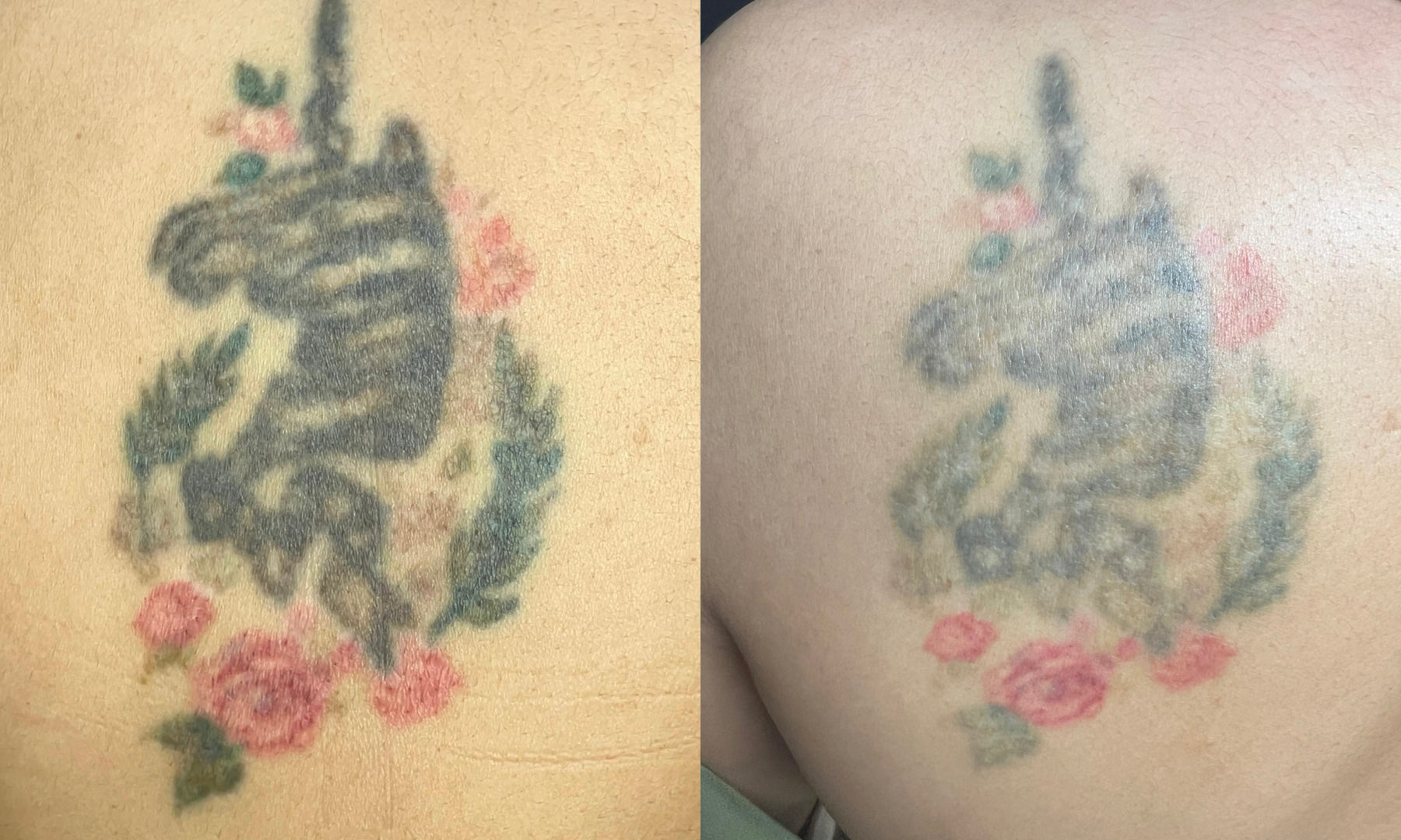 photo output — ADC Aesthetic Derma Centre
