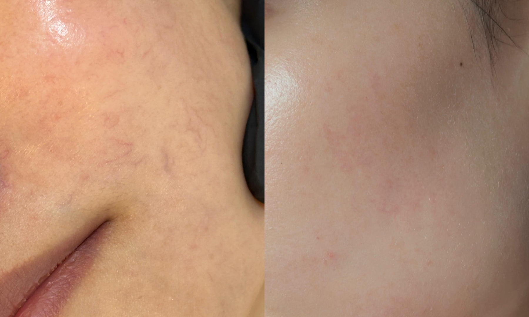 photo output 20 — ADC Aesthetic Derma Centre