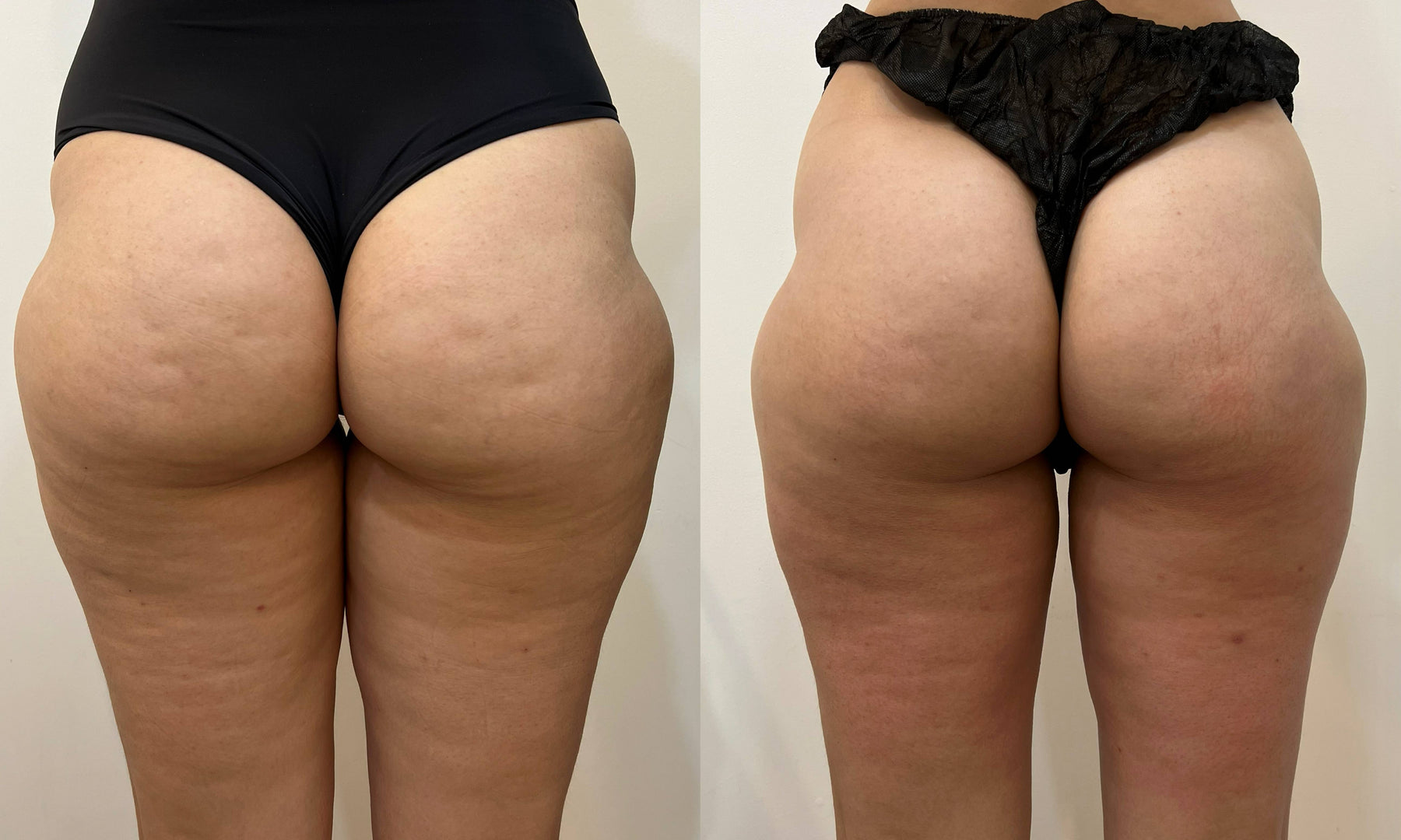 photo output 6 — ADC Aesthetic Derma Centre