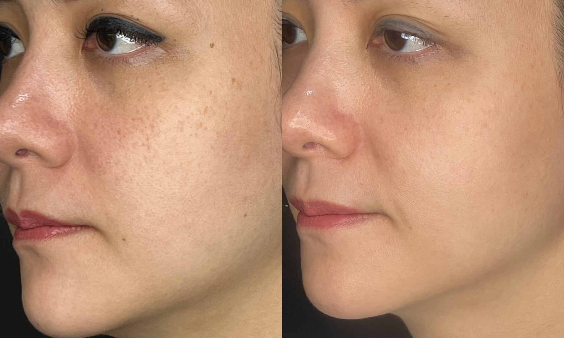 photo output 64 1 — ADC Aesthetic Derma Centre